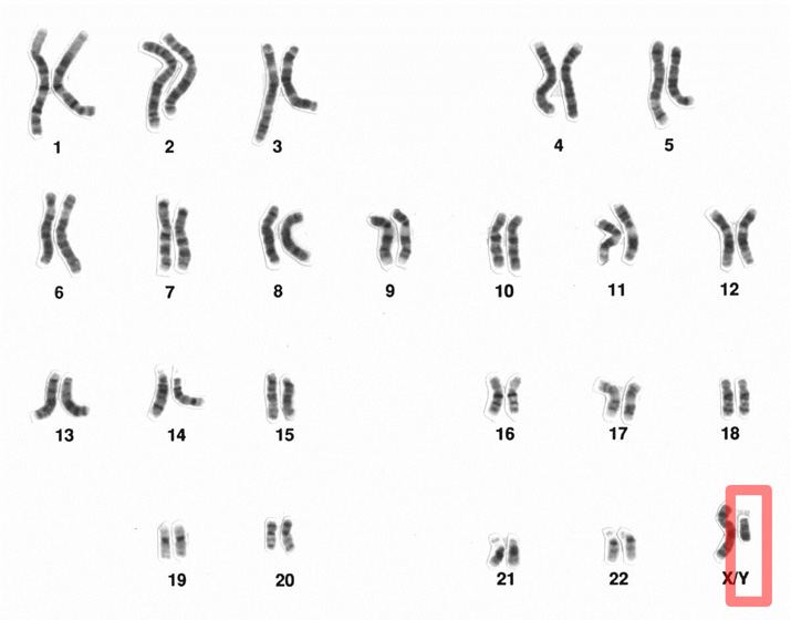 23 pairs of human chromosomes